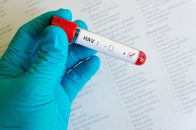 Blood sample with hepatitis A virus (HAV) positive