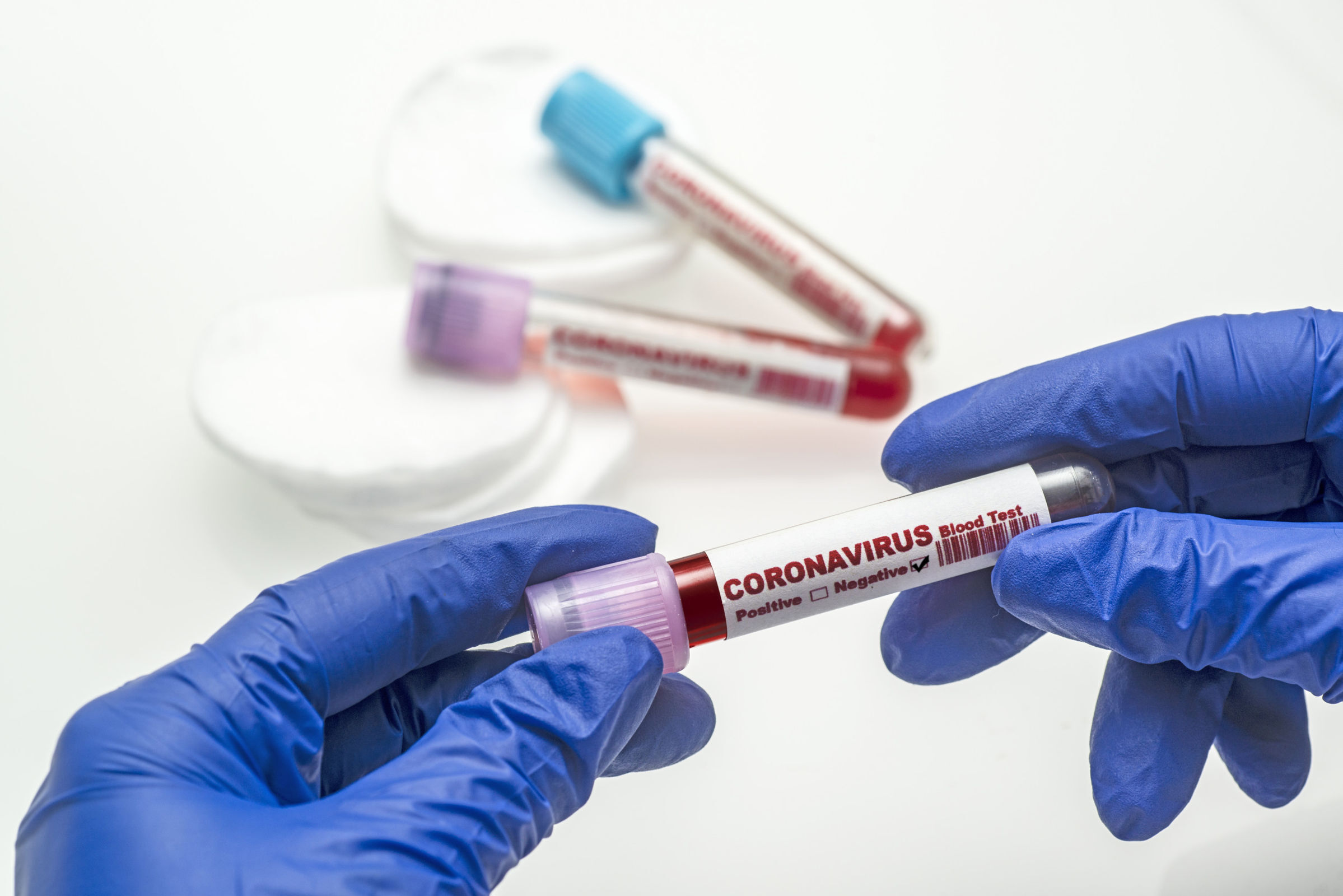 coronavirus-test