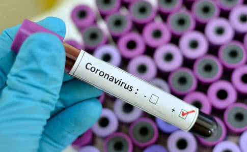 a2acaf5-coronavirus