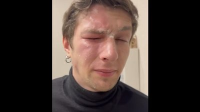 У Львові сусідка розпилила газовий балончик в обличчя ветерану (ВІДЕО)