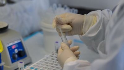 Вакцину проти хантавірусу розробляють роками через брак фінансування, - NYT