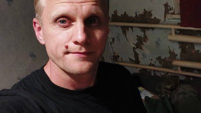 Шабунін заявив, що ДБР і Офіс Генпрокурора “злили” в соцмережі його інтимні фото з телефону, вилученого під час обшуку