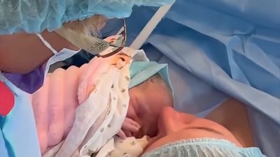 У Львові з різницею в одну хвилину народилися двійнята з окремими плацентами