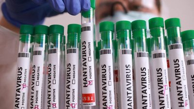 У Хмельницькому двоє людей перехворіли хантавірусом