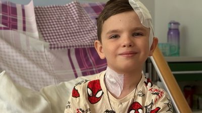 У Львові нейрохірурги провели операцію на мозку 6-річній дитині