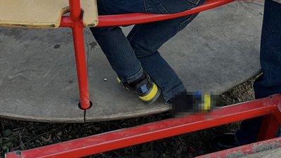 На Львівщині рятувальники вивільнили ногу дитини, затиснуту в металевій каруселі