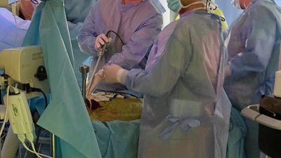 Львівські лікарі врятували життя 10-місячному пацієнту з пухлиною печінки