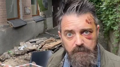 У Києві разом із балконом впав американський режисер, який приїхав знімати фільм про війну в Україні (ВІДЕО)