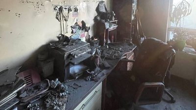 У Львові просять допомогти учню, який постраждав під час пожежі