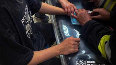 У Львові рятувальники зняли кільце з набряклого пальця хлопця