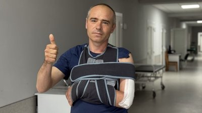 У Львові виконали складну реконструктивну операцію з пересадки нерва військовому, щоб він міг відчувати руку (ФОТО)