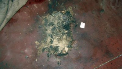 У Дніпрі в руках у підлітка вибухнув боєприпас