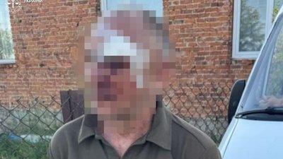 У Львівській області чоловік поранив ножем матір своєї співмешканки