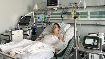 У Львові 32-річний чоловік очікує на трансплантацію серця в найпріоритетнішому статусі по Україні
