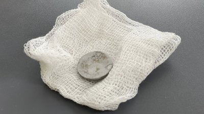 У Львові врятували 2-річну дитину, яка всю зиму прожила із батарейкою у стравоході