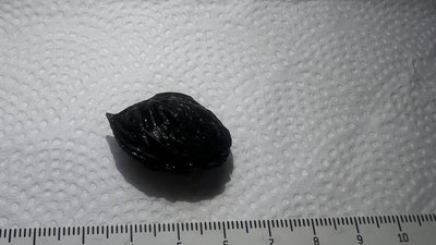 На Львівщині чоловіку загрожувала смерть через персикову кісточку (ФОТО)