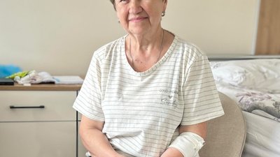 Львівські лікарі прооперували жінку з рідкісною патологією стравоходу