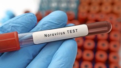 На Львівщині 29 людей госпіталізували після відвідування Буковелю