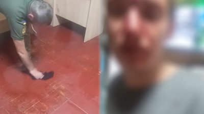У Рівненському ТЦК відреагували на заяву чоловіка, що на відео його кров витирають