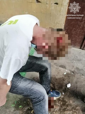 У Львові чоловік мало не загинув, вдарившись головою в бетонний стовп