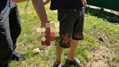 Школяр втратив пальці через вибухівку, знайдену на вулиці