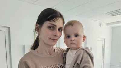 У Львові хірурги врятували немовля з вродженою вадою