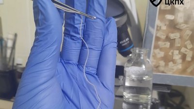 З ока жінки видалили 11-сантиметрового глиста