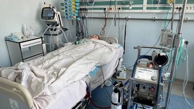 Унікальний медичний випадок у Львові: три серця в грудях одного хлопця за три доби (ФОТО)