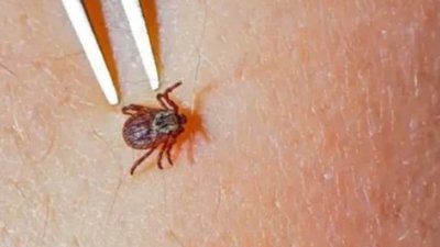 На Івано-Франківщині виявили кліщів зі збудником туляремії