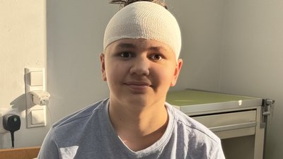 У Львові нейрохірурги 12 годин видаляли пухлину мозку у 13-річного підлітка