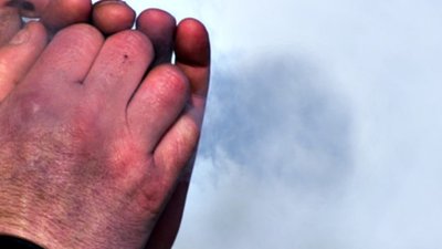 Мешканець Стрийського району потрапив до лікарні з важким переохолодженням