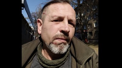 Поліція перевіряє інформацію про побиття колишнього полоненого Володимира Балуха у ТЦК