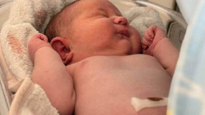 У Львові медики врятували вагітну з тиском 200/110 та немовля вагою 5 кг