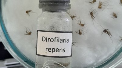 На Рівненщині з ноги жінки видалили довжелезного паразита