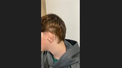У Львові медики формують вухо 12-річному хлопчику із його ребра