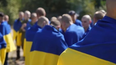Українському військовому почали видаляти напис "Слава России", який йому зробили росіяни у полоні (ФОТО)