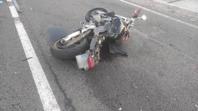 У Кам’янці-Бузькій в аварії постраждав 35-річний мотоцикліст