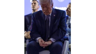 Трамп пояснив звідки беруться синці на його руках і готується до медобстеження