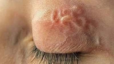 Львів’янин після відпочинку в санаторії Одеси потрапив до лікарні