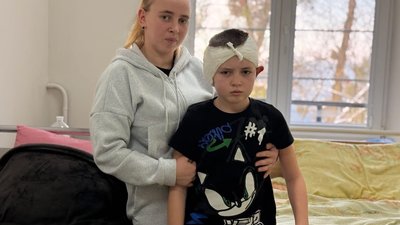 У Львові лікарі повернули слух 10-річному хлопчику