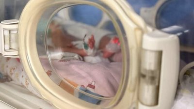 У Львові жінка з гострим панкреатитом народила доньку на 34-му тижні вагітності